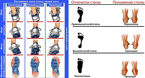 В зависимости от типа пронации необходимо подобрать обувь, которая скорректирует физиологические особенности свода стопы. Это необходимо, чтобы в процессе тренировок не усугубилось состояние суставов.